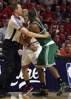 rondo-elbow.jpg