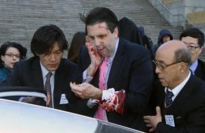 U.S. Ambassador to South Korea Lippert leaves after he was slashed in the face by an unidentified assailant at a public forum in central Seoul